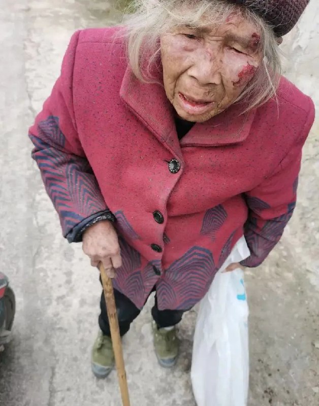隔壁村一个老奶奶摔倒在路上，我骑电动车路过，看她半天起不来，我看不下去了就去扶她起来，她眉毛和脸摔破了，地上有一小摊血，我帮她简单清理伤口就送她回家了